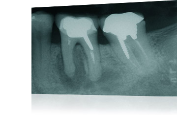 Trattamenti Studio Fratus: Endozia