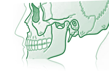 Trattamenti Studio Fratus: Gnatologia