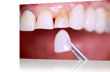 Trattamenti Studio Fratus: Odontoiatria estetica